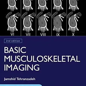 خرید و دانلود نسخه کامل کتاب Basic Musculoskeletal Imaging, Second Edition 2nd Edition