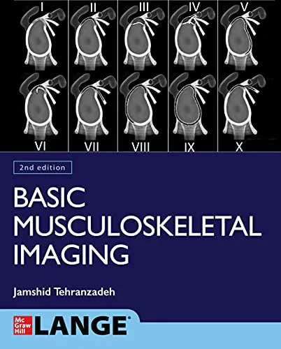 خرید و دانلود نسخه کامل کتاب Basic Musculoskeletal Imaging, Second Edition 2nd Edition_6a6cfd026183d.jpeg خرید و دانلود نسخه کامل کتاب Basic Musculoskeletal Imaging, Second Edition 2nd Edition