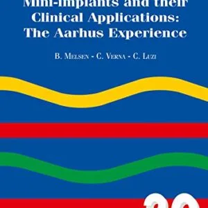 خرید و دانلود نسخه کامل کتاب Mini-implants And Their Clinical Applications: The Aarhus Experience Kindle Edition