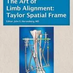 خرید و دانلود نسخه کامل کتاب The Art of Limb Alignment: Taylor Spatial Frame [Print Replica] Kindle Edition
