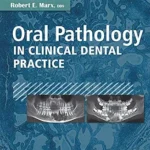 خرید و دانلود نسخه کامل کتاب Oral Pathology in Clinical Dental Practice