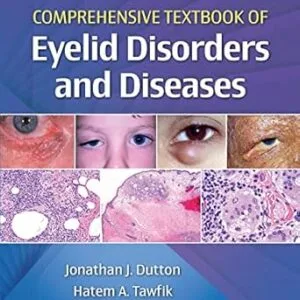 خرید و دانلود نسخه کامل کتاب Comprehensive Textbook of Eyelid Disorders and Diseases