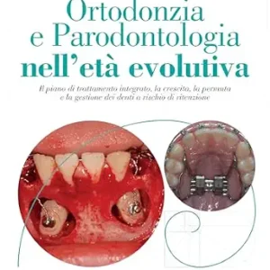 خرید و دانلود نسخه کامل کتاب Ortodonzia e Parodontologia nell’età evolutiva (Italian Edition)