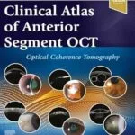 خرید و دانلود نسخه کامل کتاب Clinical Atlas of Anterior Segment OCT: Ocular Coherence Tomography – E-Book