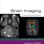 خرید و دانلود نسخه کامل کتاب Brain Imaging: Case Review Series 2nd Edition