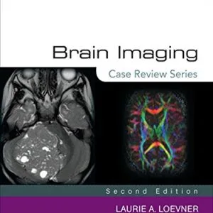 خرید و دانلود نسخه کامل کتاب Brain Imaging: Case Review Series 2nd Edition