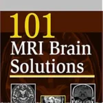 خرید و دانلود نسخه کامل کتاب 101 MRI Brain Solutions