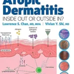 خرید و دانلود نسخه کامل کتاب Atopic Dermatitis: Inside Out or Outside In – E-Book