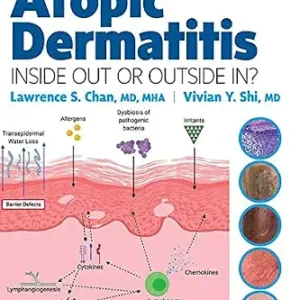 خرید و دانلود نسخه کامل کتاب Atopic Dermatitis: Inside Out or Outside In – E-Book