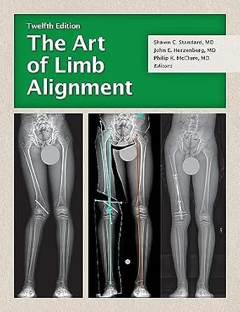 خرید و دانلود نسخه کامل کتاب The Art of Limb Alignment, Twelfth Edition_6a7ecb893ae0e.jpeg خرید و دانلود نسخه کامل کتاب The Art of Limb Alignment, Twelfth Edition