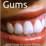 خرید و دانلود نسخه کامل کتاب Bleeding Gums
