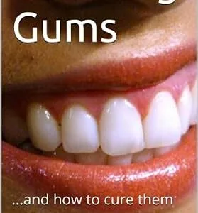 خرید و دانلود نسخه کامل کتاب Bleeding Gums