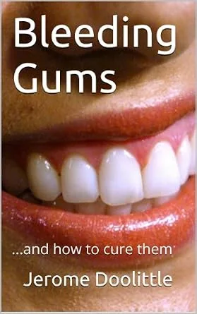 خرید و دانلود نسخه کامل کتاب Bleeding Gums_6a6847602b70c.jpeg خرید و دانلود نسخه کامل کتاب Bleeding Gums