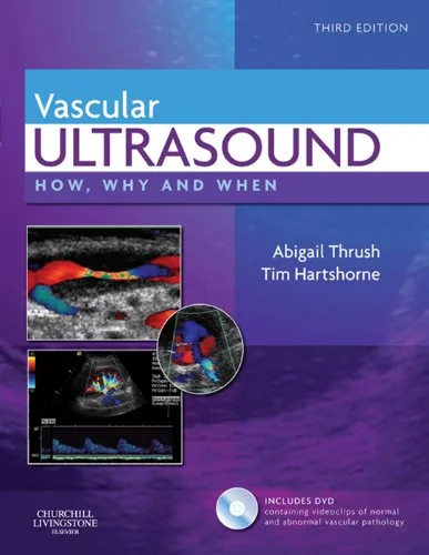 خرید و دانلود نسخه کامل کتاب Vascular Ultrasound: How, Why and When 3rd Edition_6a70e6f76fa1a.jpeg خرید و دانلود نسخه کامل کتاب Vascular Ultrasound: How, Why and When 3rd Edition