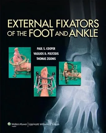 خرید و دانلود نسخه کامل کتاب External Fixators of the Foot and Ankle_6a6f572b72d8a.jpeg خرید و دانلود نسخه کامل کتاب External Fixators of the Foot and Ankle