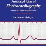 خرید و دانلود نسخه کامل کتاب Annotated Atlas of Electrocardiography: A Guide to Confident Interpretation (Contemporary Cardiology Book 3) 1999th Edition