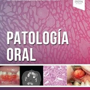 خرید و دانلود نسخه کامل کتاب Patología oral (Spanish Edition)