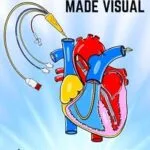 خرید و دانلود نسخه کامل کتاب Cardiac Critical Care Made Visual