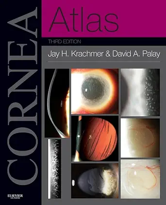 خرید و دانلود نسخه کامل کتاب Cornea Atlas E-Book (Expert Consult)_6a6f49c3678c8.webp خرید و دانلود نسخه کامل کتاب Cornea Atlas E-Book (Expert Consult)