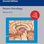 خرید و دانلود نسخه کامل کتاب زبان اصلی Neuro-Oncology (Neurosurgical Operative Atlas) PDF | دانلود کتاب خارجی