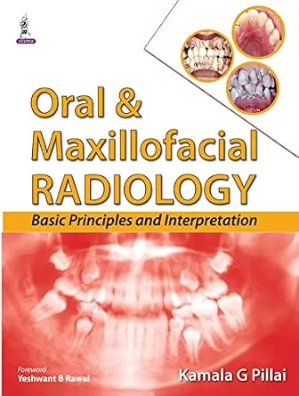خرید و دانلود نسخه کامل کتاب Oral & Maxillofacial Radiology: Basic Principles and Interpretation_6a6759a6d7490.jpeg خرید و دانلود نسخه کامل کتاب Oral & Maxillofacial Radiology: Basic Principles and Interpretation