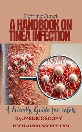 خرید و دانلود نسخه کامل کتاب Fighting Fungi: A Handbook on Tinea Infection_6a6b86b3d2d2a.webp خرید و دانلود نسخه کامل کتاب Fighting Fungi: A Handbook on Tinea Infection