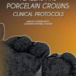 خرید و دانلود نسخه کامل کتاب Veneers and Porcelain Crowns: Clinical Protocols