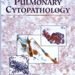 خرید و دانلود نسخه کامل کتاب Color Atlas of Pulmonary Cytopathology