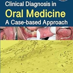 خرید و دانلود نسخه کامل کتاب Clinical Diagnosis in Oral Medicine: A Case-based Approach