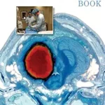خرید و دانلود نسخه کامل کتاب The NeuroICU Book, Second Edition