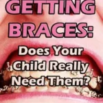 خرید و دانلود نسخه کامل کتاب Getting Braces: Does Your Child Really Need Them?