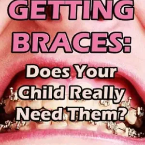 خرید و دانلود نسخه کامل کتاب Getting Braces: Does Your Child Really Need Them?