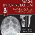 خرید و دانلود نسخه کامل کتاب Image Interpretation: Bones, Joints, and Fractures: Image Interpretation: Bones, Joints, and Fractures – E-Book