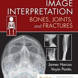 خرید و دانلود نسخه کامل کتاب Image Interpretation: Bones, Joints, and Fractures: Image Interpretation: Bones, Joints, and Fractures – E-Book