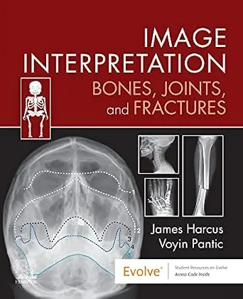 خرید و دانلود نسخه کامل کتاب Image Interpretation: Bones, Joints, and Fractures: Image Interpretation: Bones, Joints, and Fractures – E-Book_6a6ff958c92f0.jpeg خرید و دانلود نسخه کامل کتاب Image Interpretation: Bones, Joints, and Fractures: Image Interpretation: Bones, Joints, and Fractures – E-Book