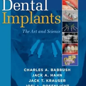 خرید و دانلود نسخه کامل کتاب Dental Implants: The Art and Science