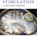 خرید و دانلود نسخه کامل کتاب Deep Brain Stimulation: A Case-based Approach