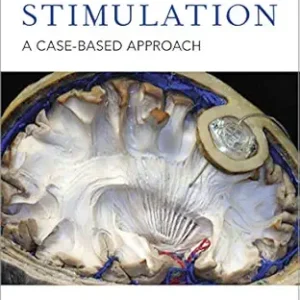 خرید و دانلود نسخه کامل کتاب Deep Brain Stimulation: A Case-based Approach