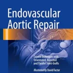 خرید و دانلود نسخه کامل کتاب Endovascular Aortic Repair: Current Techniques with Fenestrated, Branched and Parallel Stent-Grafts