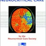خرید و دانلود نسخه کامل کتاب The Practice of Neurocritical Care Kindle Edition