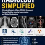 خرید و دانلود نسخه کامل کتاب RADIOLOGY SIMPLIFIED: A Practical Guide to X-Rays, CT, MRI, Ultrasound, Nuclear Medicine, Imaging Interpretation, and Clinical Applications