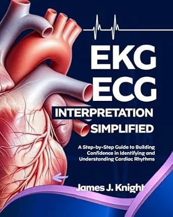 خرید و دانلود نسخه کامل کتاب EKG | ECG Interpretation Simplified : A Step-by-Step Guide to Building Confidence in Identifying and Understanding Cardiac Rhythms_6a6bc499e606e.jpeg خرید و دانلود نسخه کامل کتاب EKG | ECG Interpretation Simplified : A Step-by-Step Guide to Building Confidence in Identifying and Understanding Cardiac Rhythms