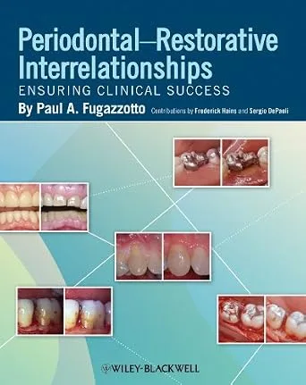 خرید و دانلود نسخه کامل کتاب Periodontal-Restorative Interrelationships: Ensuring Clinical Success_6a666a581cd8f.jpeg خرید و دانلود نسخه کامل کتاب Periodontal-Restorative Interrelationships: Ensuring Clinical Success