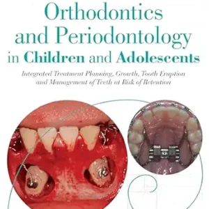 خرید و دانلود نسخه کامل کتاب Orthodontics and Periodontology in Children and Adolescents: Integrated Treatment Planning, Growth, Tooth Eruption and Management of Teeth at Risk of Retention