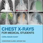 خرید و دانلود نسخه کامل کتاب Chest X-Rays for Medical Students: CXRs Made Easy 2nd Edition