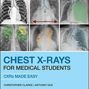 خرید و دانلود نسخه کامل کتاب Chest X-Rays for Medical Students: CXRs Made Easy 2nd Edition