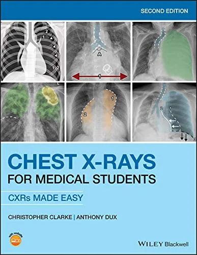 خرید و دانلود نسخه کامل کتاب Chest X-Rays for Medical Students: CXRs Made Easy 2nd Edition_6a6e191eb0d2e.jpeg خرید و دانلود نسخه کامل کتاب Chest X-Rays for Medical Students: CXRs Made Easy 2nd Edition