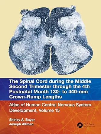 خرید و دانلود نسخه کامل کتاب زبان اصلی The Spinal Cord during the Middle Second Trimester through the 4th Postnatal Month 130- to 440-mm Crown-Rump Lengths: Atlas of Human Central Nervous System Development, Volume 15 PDF | دانلود کتاب خارجی_6a93841e724c0.webp خرید و دانلود نسخه کامل کتاب زبان اصلی The Spinal Cord during the Middle Second Trimester through the 4th Postnatal Month 130- to 440-mm Crown-Rump Lengths: Atlas of Human Central Nervous System Development, Volume 15 PDF | دانلود کتاب خارجی