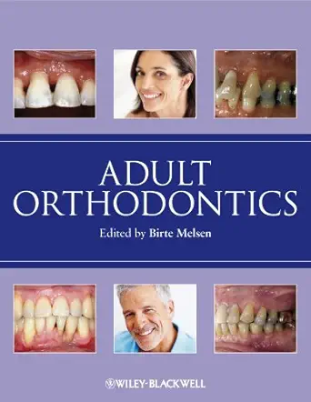 خرید و دانلود نسخه کامل کتاب Adult Orthodontics_6a6864581a062.webp خرید و دانلود نسخه کامل کتاب Adult Orthodontics