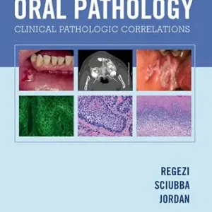 خرید و دانلود نسخه کامل کتاب Oral Pathology – E-Book